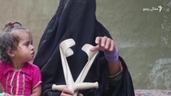تاج مینه وايي چاودنه کې تر معیوبېدو وروسته یې ښه ورځ نه ده لیدلې