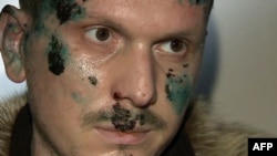 Adam Osmaýewi Ukrainanyň ýörite güýçleri tussag edipdirler.