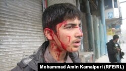 Afganistanski dječak ranjen u samoubilačkom napadu u provinciji Nangarhar u blizini grada Jalalabad, 19. siječanj 2011.